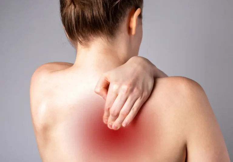 Upper Back Pain Between Shoulder Blades Relief